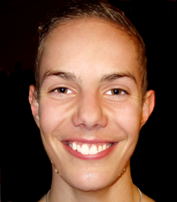 Broquard Jerome Schnellste Herr u Titelverteidiger 2013